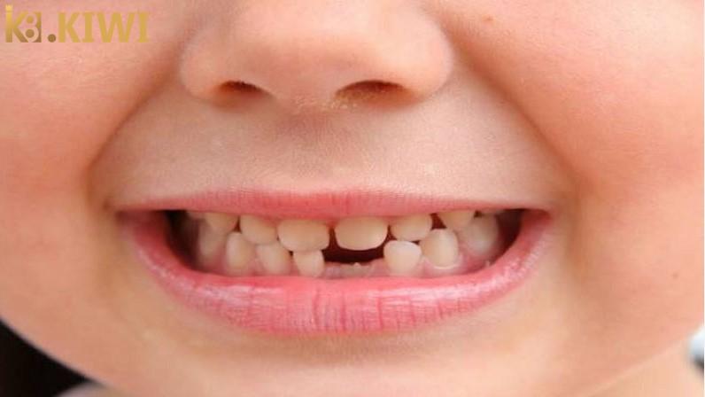 Giấc mơ rụng răng có điềm báo gì và nên đánh số tài lộc nào? 6 Nằm mơ rụng răng không chảy máu có điềm gì?